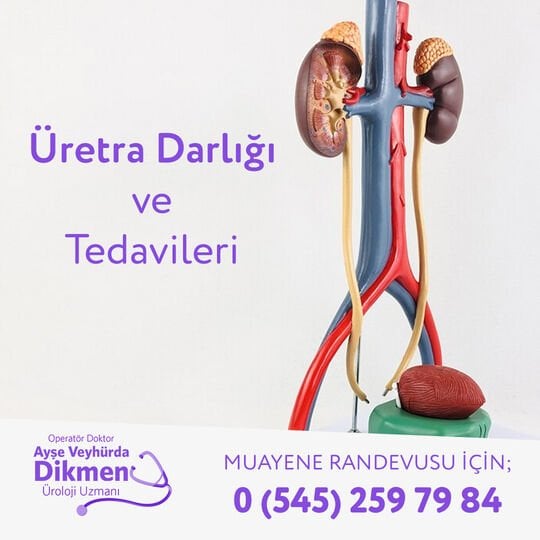 Üretra Darlığı Tedavisi